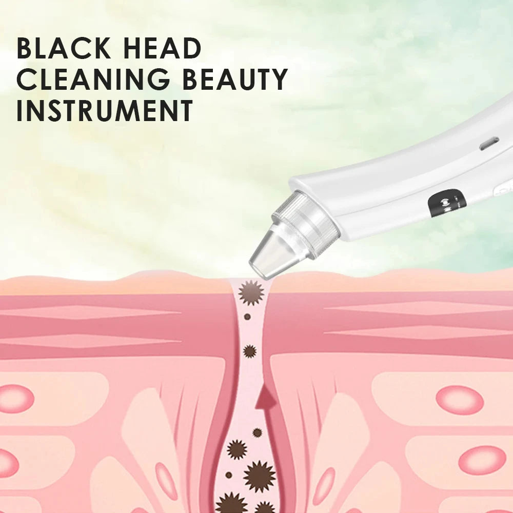 Electric Vacuum Blackhead Remover